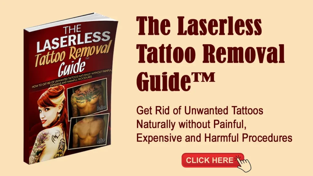 tattoo removal guide